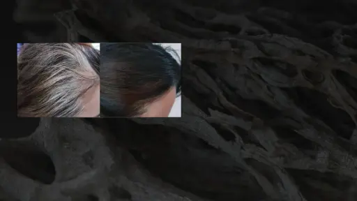 【预约订金】防脱护理