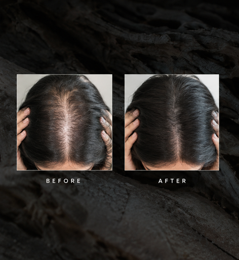 [Appointment Deposit]$298 Anti-Hairloss Treatment.